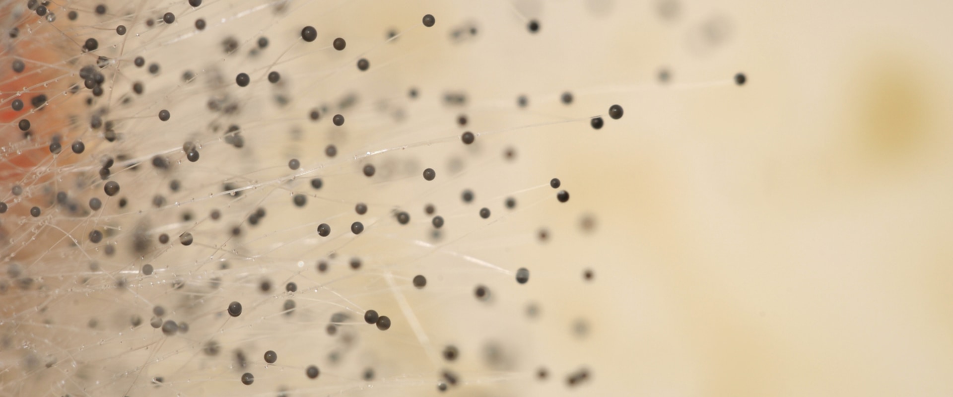 Will an Air Purifier Help with Mold?